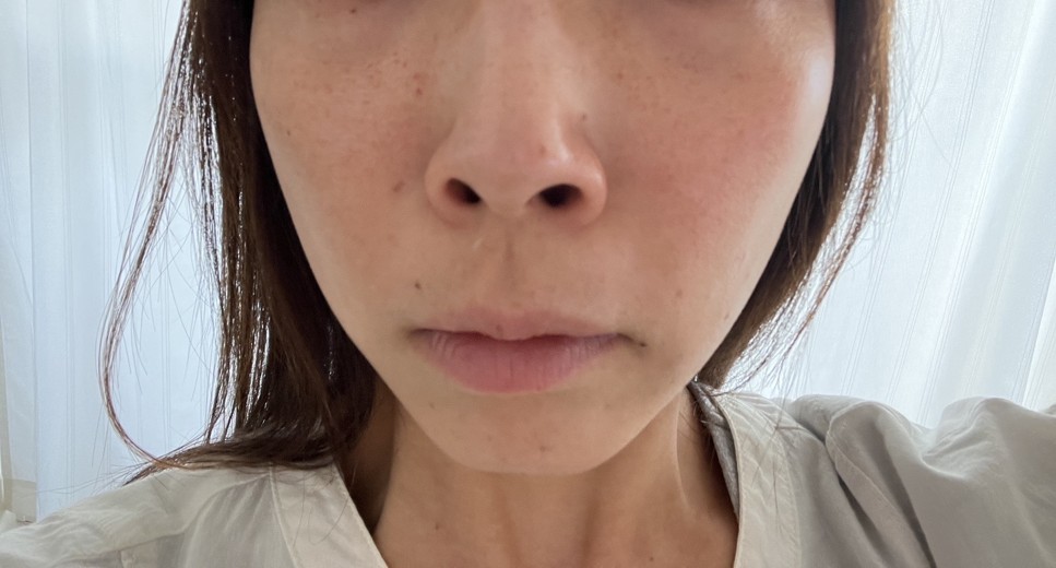 after photo: ルメッカ