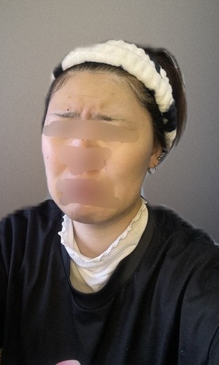 before photo: ルメッカ