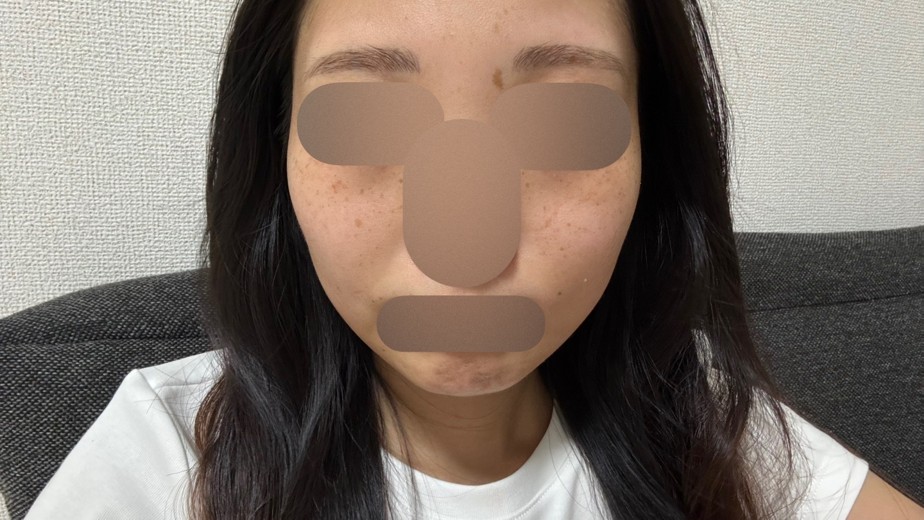 before photo: ルメッカ