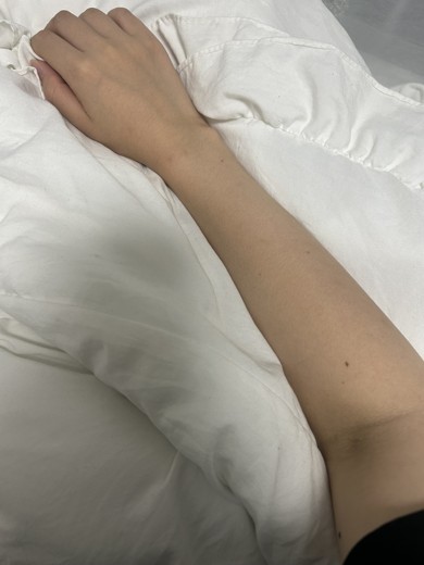 after photo: 白玉注射・点滴
