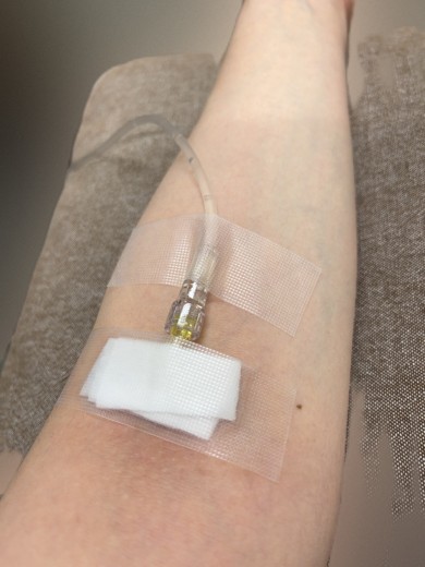 after photo: 白玉注射・点滴, 美容注射・点滴