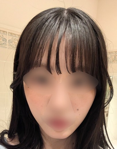 before photo: ウルトラセルZi・リニアZ(ハイフ)