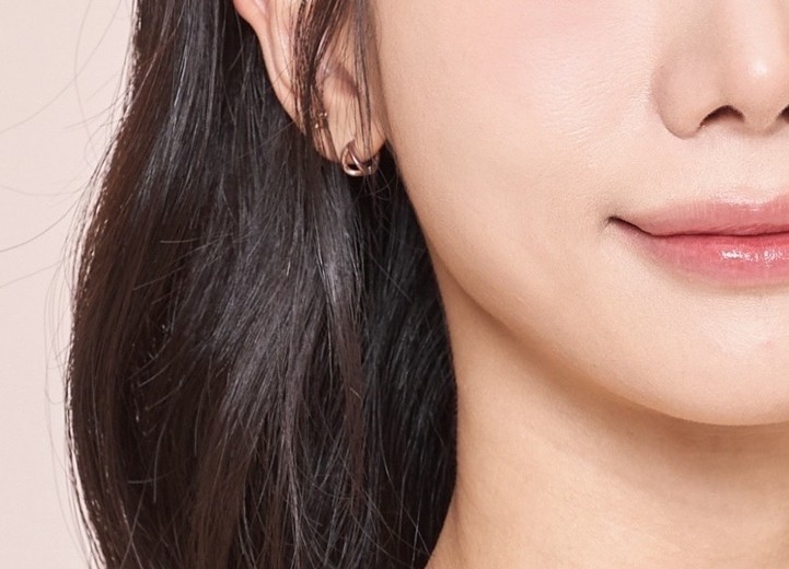 after photo: 티타늄리프팅