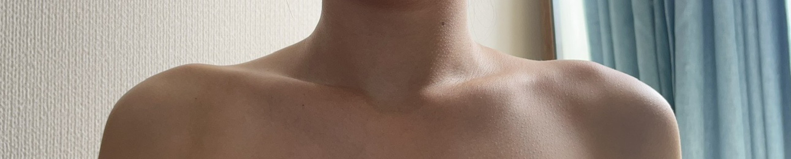 after photo: 脇ボトックス, エラボトックス, 肩ボトックス(僧帽筋)