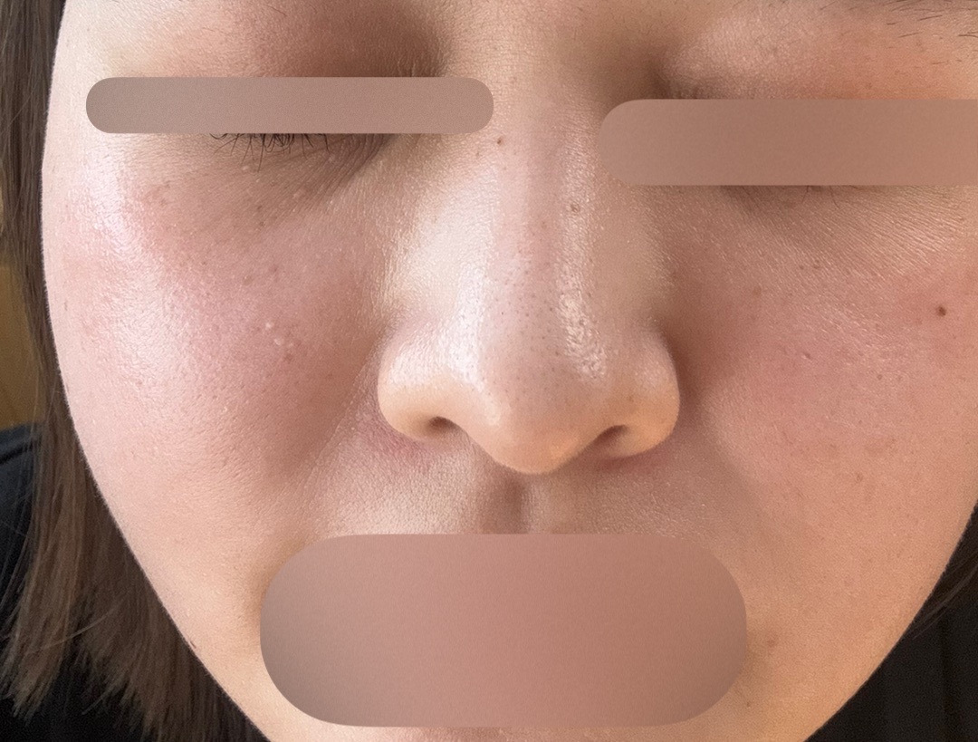 ⚠️1/26〜2/8発送出来ません　コラーゲンピール×２本 makimaki17171717 コラーゲンピール×2本 楽天市場】＼楽天1位／【全品