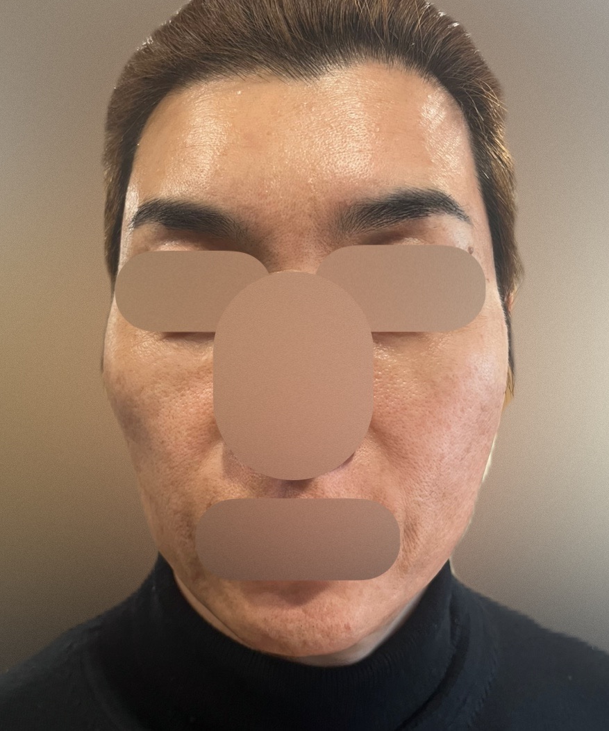 ララピール | リズオン・ウィズ・延世スリムライン医院