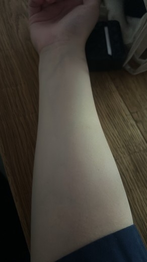 after photo: ビタミン注射・点滴