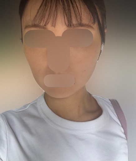 after photo: リニアファーム(ハイフ)