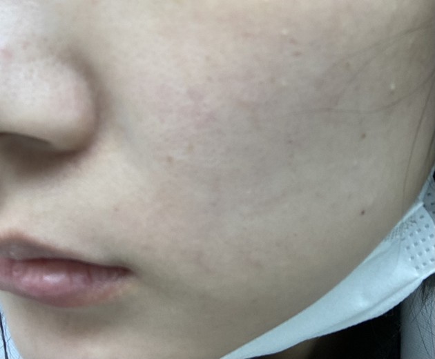 after photo: ルメッカ