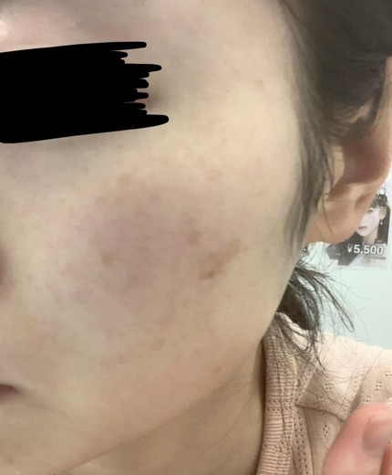 before photo: ルメッカ