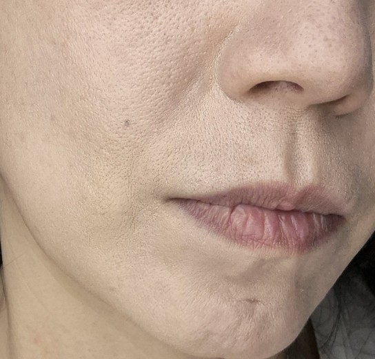 after photo: 쥬브젠