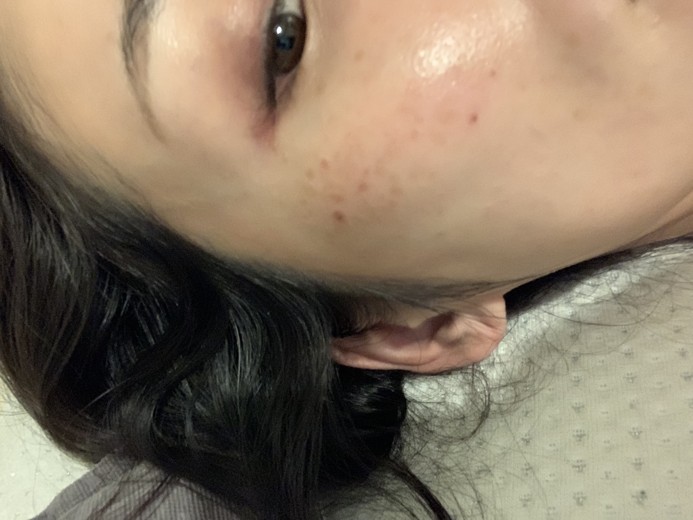 after photo: ルメッカ