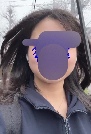 after photo: インモード
