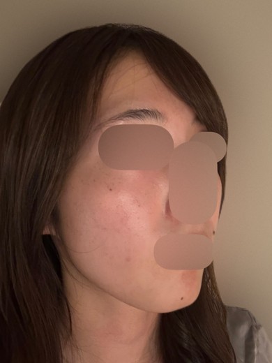 after photo: ルメッカ