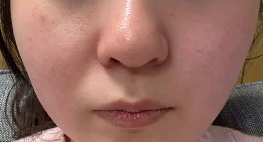 美容師必見 ZX-CLINIC【公式】｜大阪梅田・北新地からすぐの安くて承認機