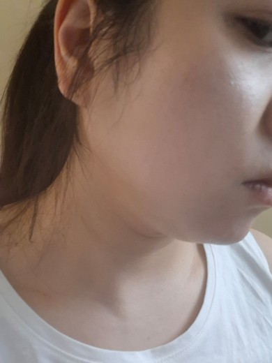 after photo: ルメッカ