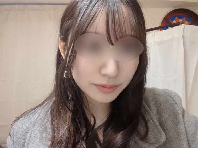 before photo: マッサージピール(コラーゲンピール)
