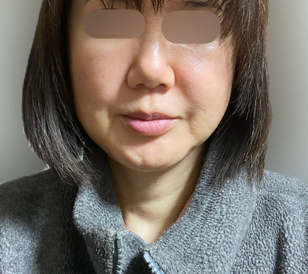 ZX-CLINIC【ゼクスクリニック】の施術口コミ1290件