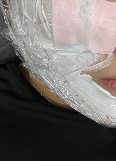 before photo: 윤곽주사