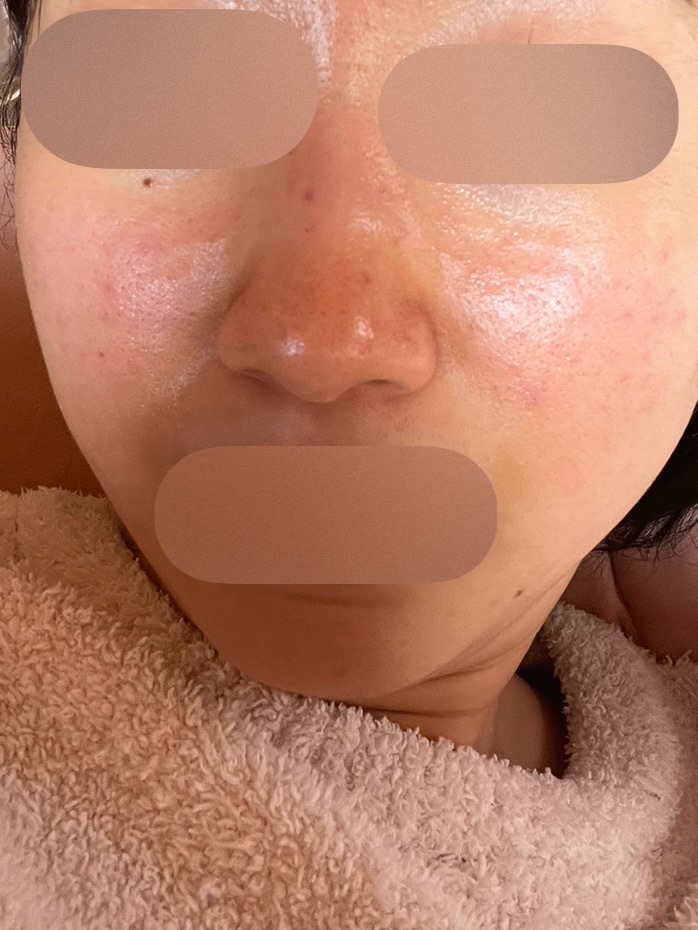 ご縁ある方にお譲りします！様REJURAN ×2本、stem cell 1本 ご縁ある方にお譲りします！様REJURAN ×2本、stem cell