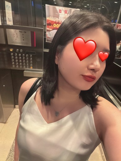 after photo: 콧대(보형물), 코끝(자가연골)