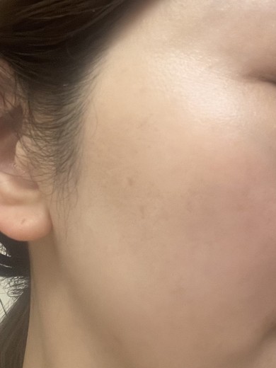before photo: ルメッカ