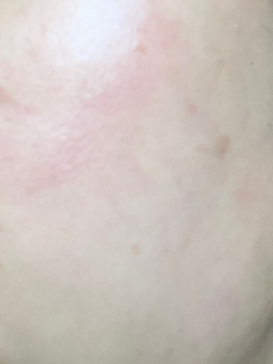 after photo: エレクトロポレーション, 診断・検査