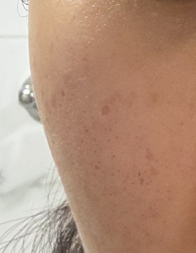 before photo: 쥬베룩