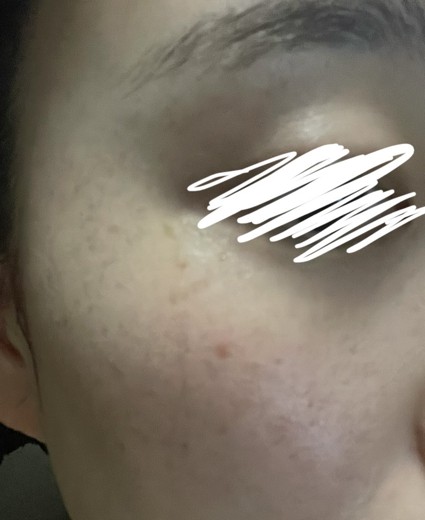 after photo: ルメッカ