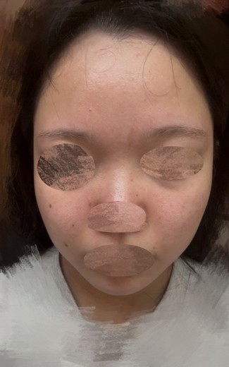after photo: 診断・検査
