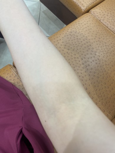 before photo: ダイエット点滴/注射