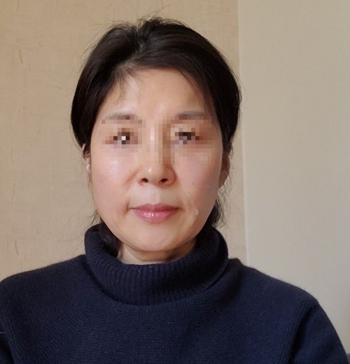 after photo: 쥬베룩