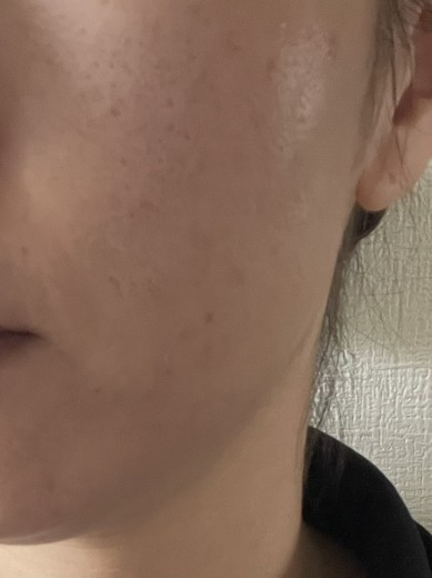 after photo: ショッピングリフト(ショートスレッド)