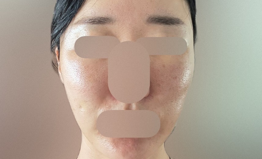 before photo: 엘라비에리투오