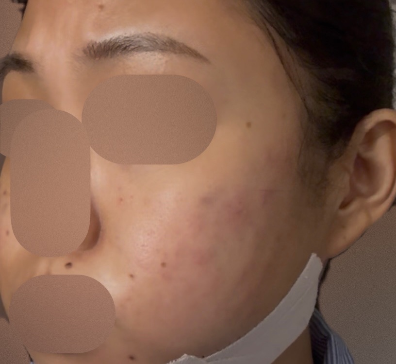 ララピール | リズオン・ウィズ・延世スリムライン医院