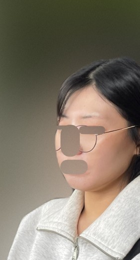 before photo: 인모드리프팅