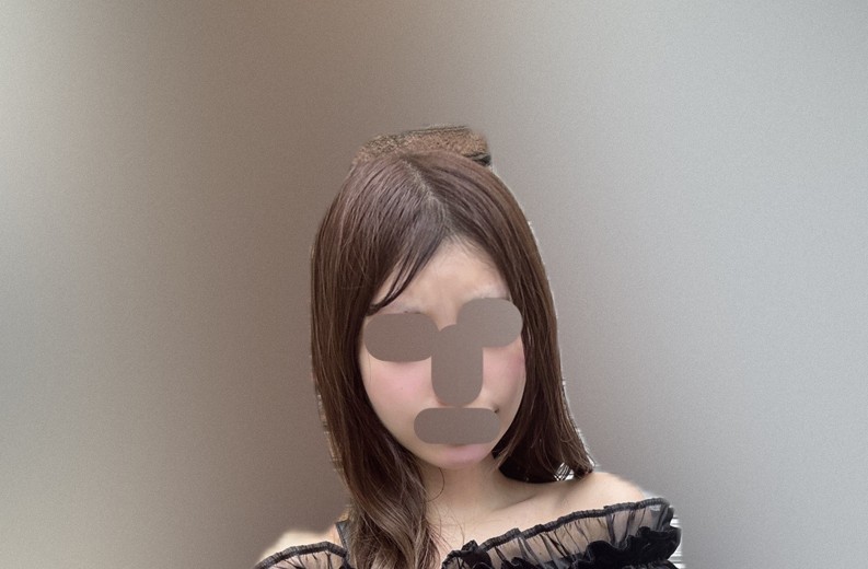 after photo: イオン導入