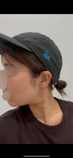before photo: リニアファーム(ハイフ)