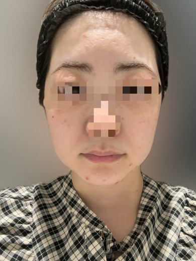 before photo: 診断・検査