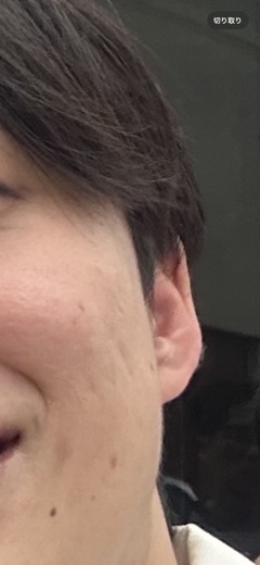 before photo: ポテンツァ(POTENZA)