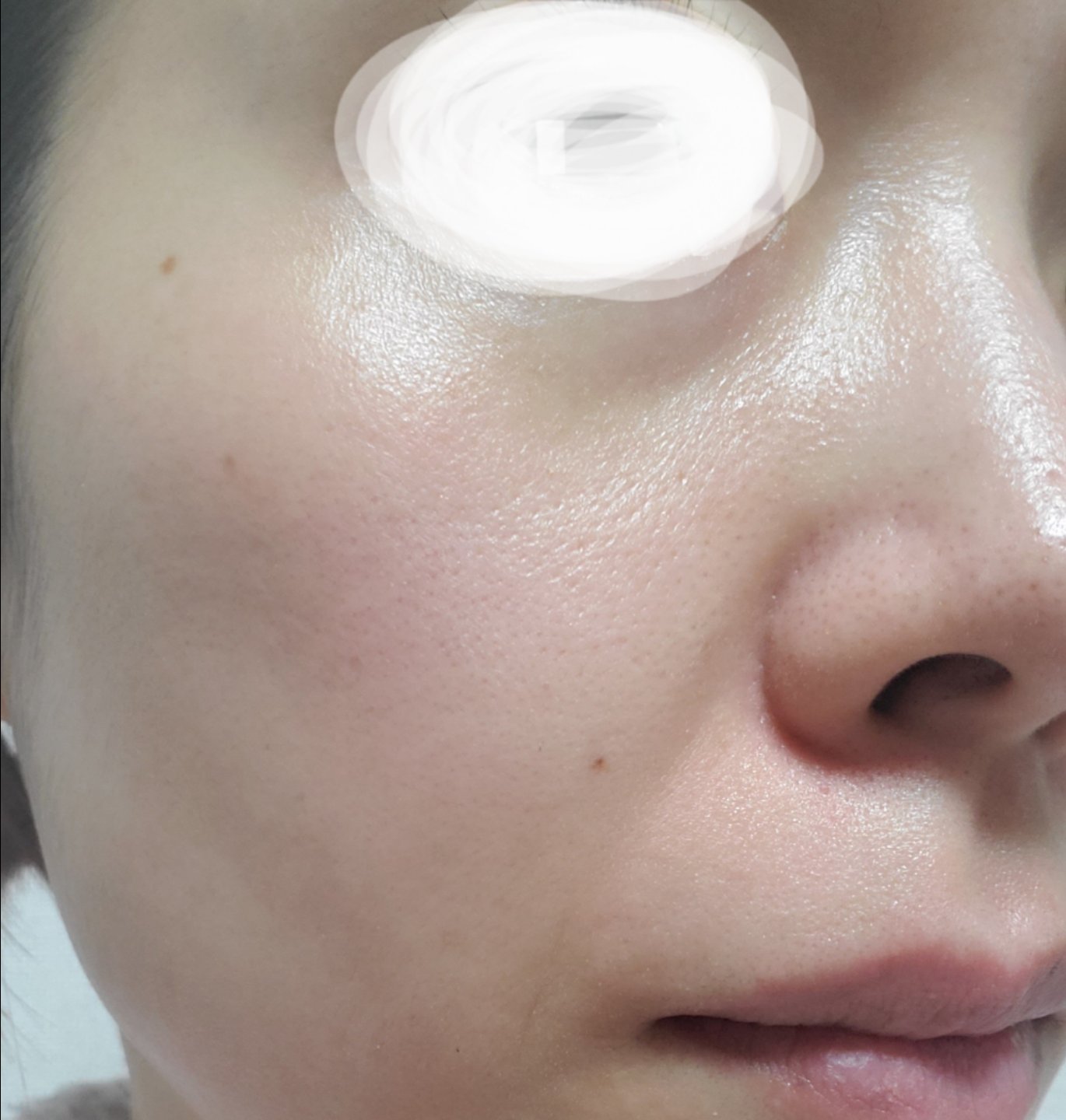 再来OK】ハイドラフェイシャル＋エレクトロポレーション | おおかみ