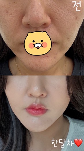 after photo: 쥬베룩