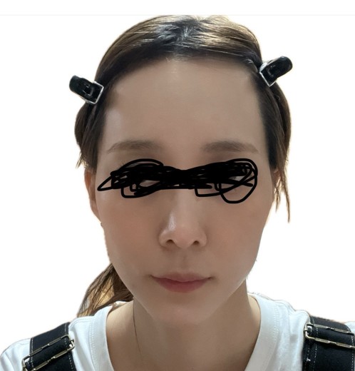 before photo: ジュベルック(Juvelook)