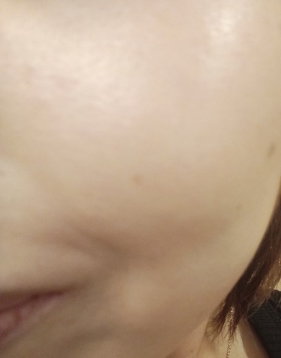 after photo: ボルニューマ