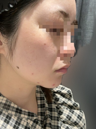 before photo: 診断・検査