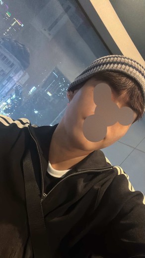 before photo: 사각턱보톡스