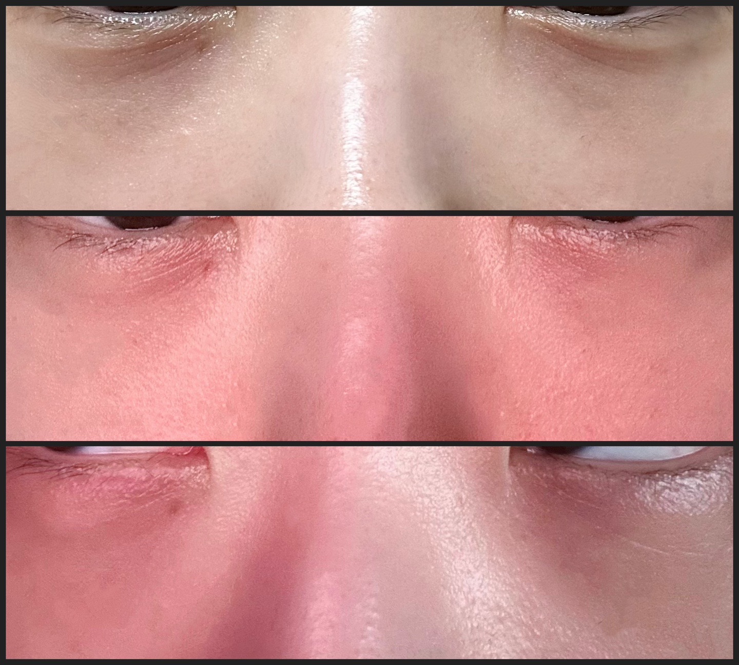 시술 후