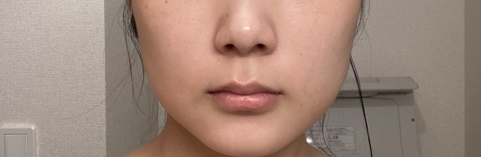 before photo: ボルニューマ