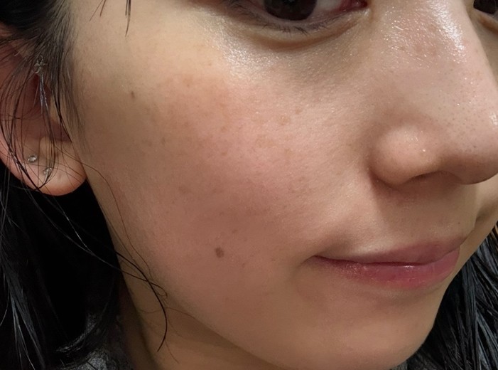 after photo: ルメッカ