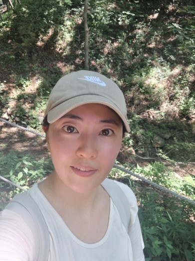 after photo: 프락셀레이저, 디오레듀얼